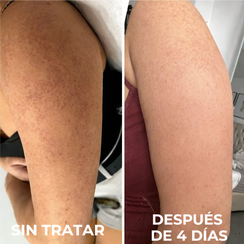 Crema para piel de gallina